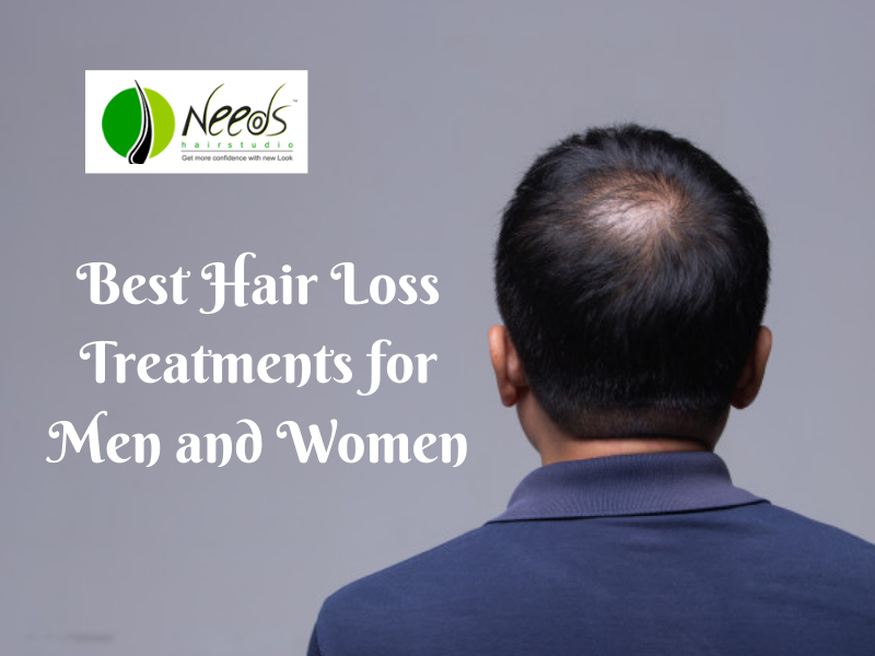 Best Hair Loss Treatments for Men and Women