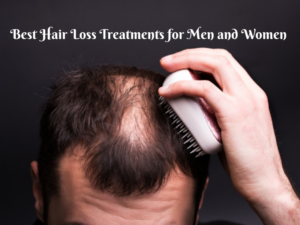 Best Hair Loss Treatments for Men and Women 