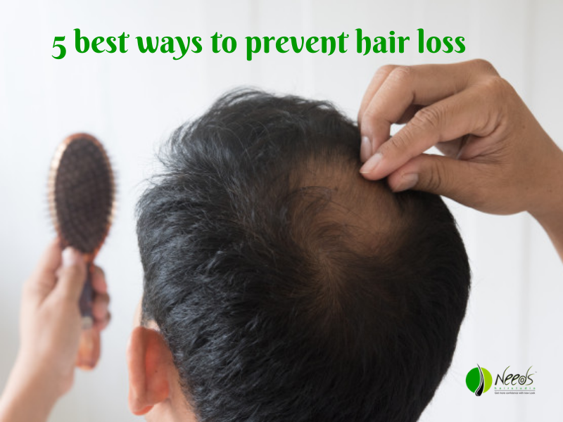 5 best ways to prevent hair loss
