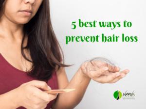 5 best ways to prevent hair loss 