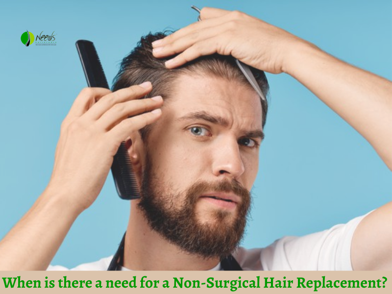 When is there a need for a Non-Surgical Hair Replacement?