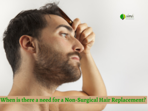 When is there a need for a Non-Surgical Hair Replacement? 