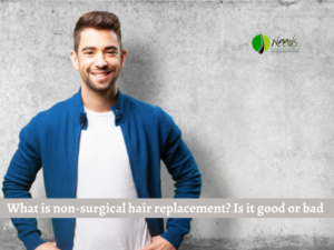 What is non-surgical hair replacement? Is it good or bad 
