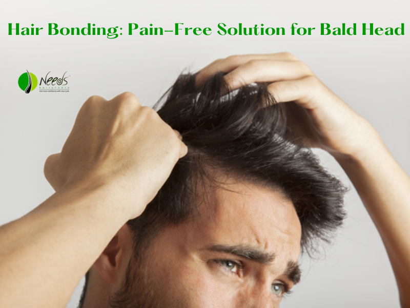 Hair Bonding: Pain-Free Solution for Bald Head