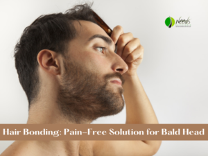 Hair Bonding: Pain-Free Solution for Bald Head 