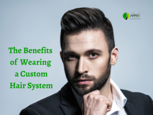 The Benefits of Wearing a Custom Hair System 