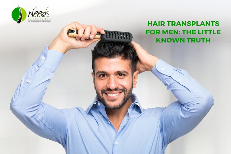 Hair Transplants For Men: The Little Known Truth