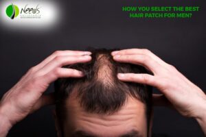 How you select the best hair patch for men? 