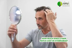 How much does a hair patch cost in Hyderabad?