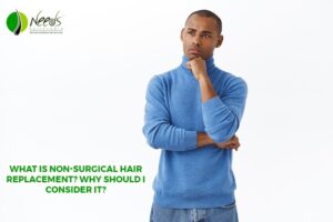 Non-Surgical Hair Replacement and Why Consider It?