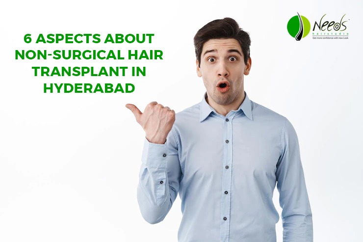 6 Aspects Of Non-Surgical Hair Transplant in Hyderabad