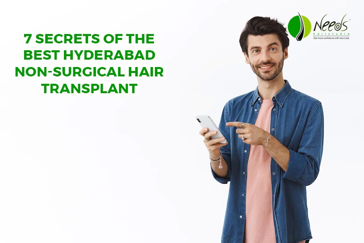 7 Secrets of the best Hyderabad Non-Surgical Hair Transplant
