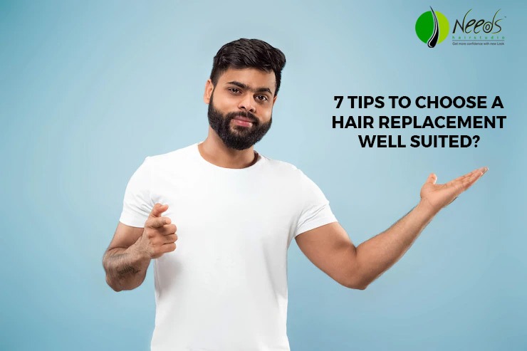7 tips to choose a hair replacement well suited?