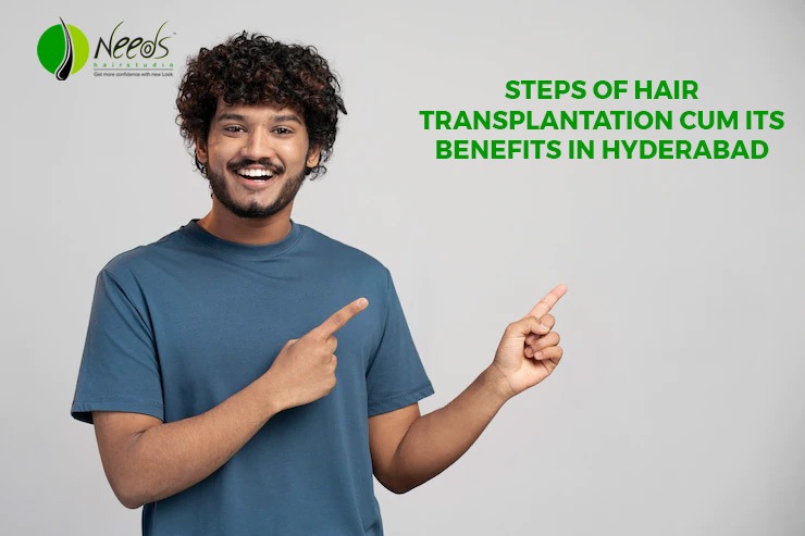 Steps of hair transplantation cum its benefits in Hyderabad