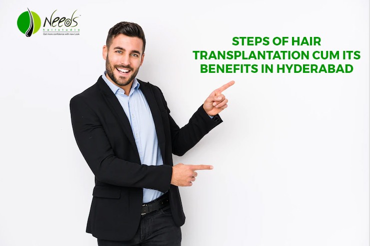 Steps of hair transplantation cum its benefits in Hyderabad