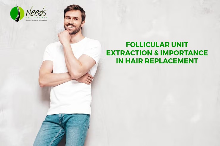 Follicular Unit Extraction & importance in Hair Replacement