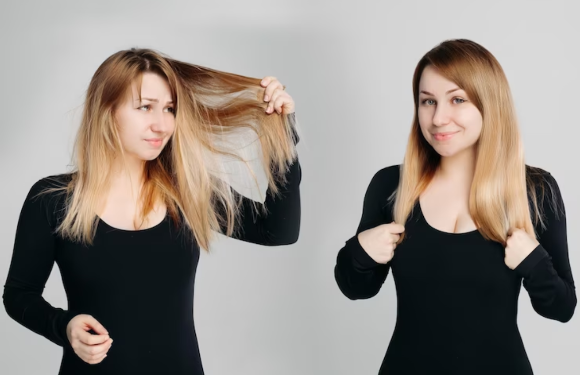 Hair Integration vs Traditional Wigs: which is better for you?