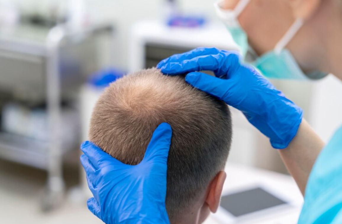 How Advanced Hair Replacement is Transforming Lives?