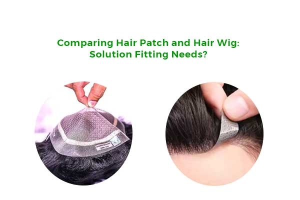 Comparing Hair Patch and Hair Wig: Solution Fitting Needs?